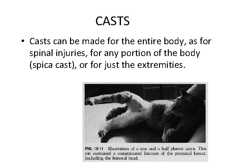 CASTS • Casts can be made for the entire body, as for spinal injuries,