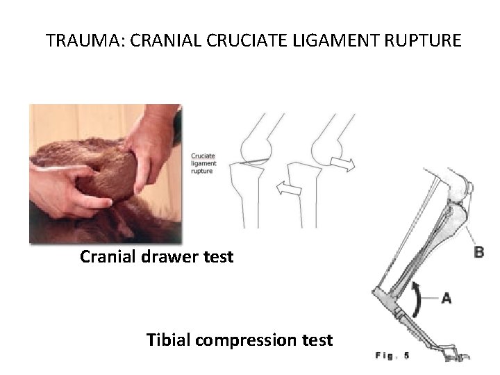 TRAUMA: CRANIAL CRUCIATE LIGAMENT RUPTURE Cranial drawer test Tibial compression test 