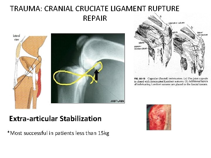 TRAUMA: CRANIAL CRUCIATE LIGAMENT RUPTURE REPAIR Extra-articular Stabilization *Most successful in patients less than