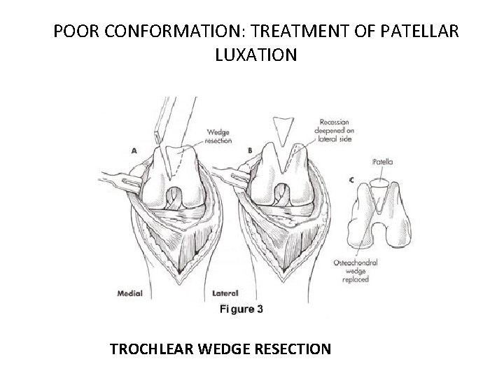 POOR CONFORMATION: TREATMENT OF PATELLAR LUXATION TROCHLEAR WEDGE RESECTION 