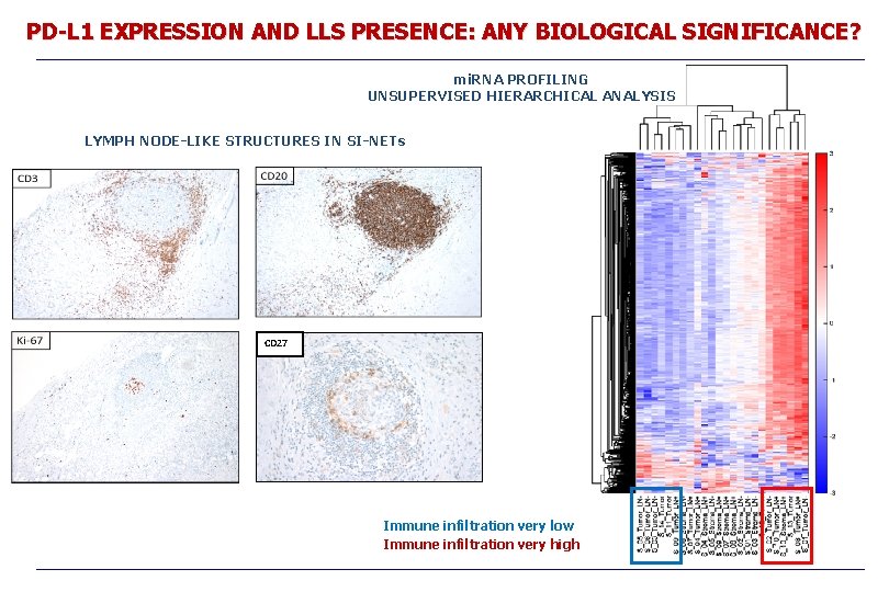 PD-L 1 EXPRESSION AND LLS PRESENCE: ANY BIOLOGICAL SIGNIFICANCE? mi. RNA PROFILING UNSUPERVISED HIERARCHICAL