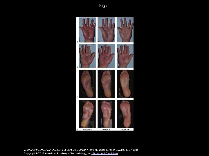 Fig 5 Journal of the American Academy of Dermatology 2017 7670 -80 DOI: (10.