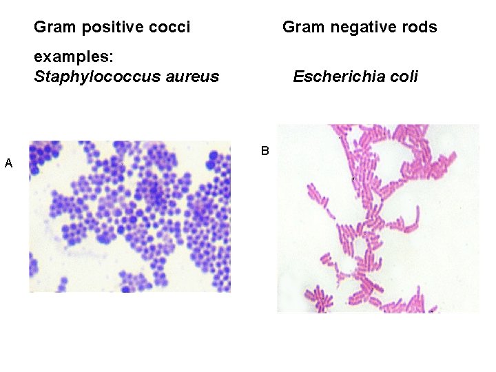 Gram positive cocci Gram negative rods examples: Staphylococcus aureus A Escherichia coli B 