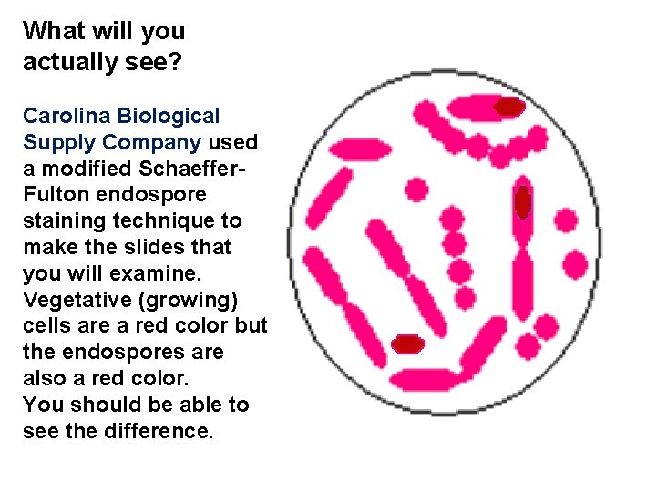 What will you actually see? Carolina Biological Supply Company used a modified Schaeffer. Fulton