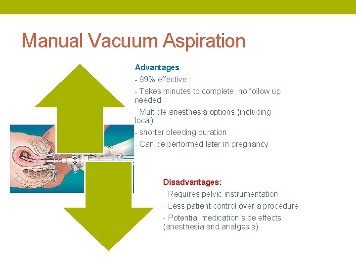 Manual Vacuum Aspiration Advantages - 99% effective - Takes minutes to complete, no follow