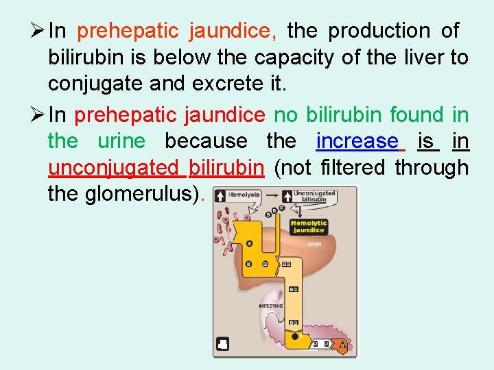 Ø In prehepatic jaundice, the production of bilirubin is below the capacity of the