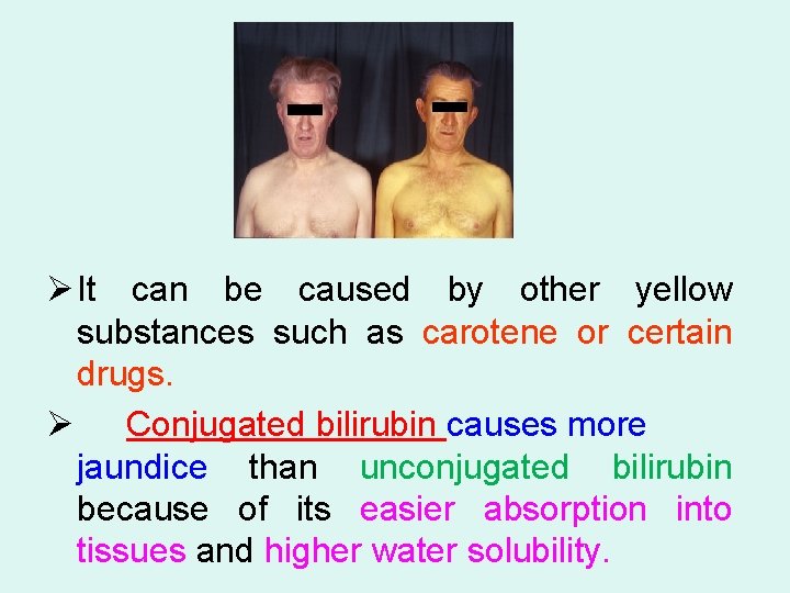Ø It can be caused by other yellow substances such as carotene or certain