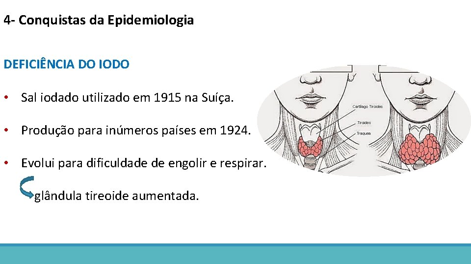 4 - Conquistas da Epidemiologia DEFICIÊNCIA DO IODO • Sal iodado utilizado em 1915