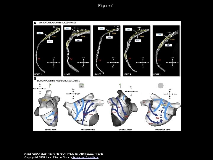 Figure 5 Heart Rhythm 2021 18349 -357 DOI: (10. 1016/j. hrthm. 2020. 11. 008)