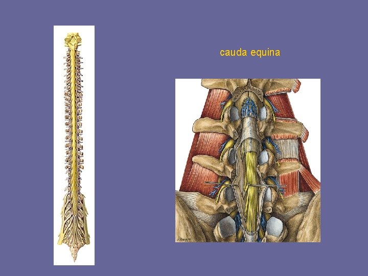 cauda equina 