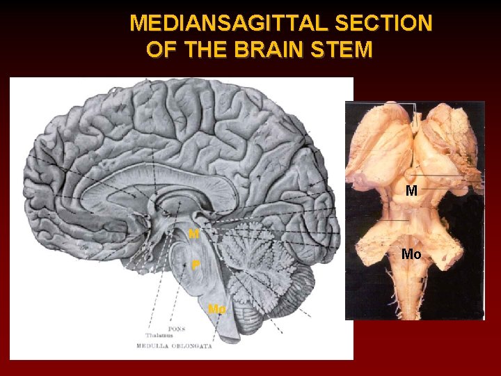 MEDIANSAGITTAL SECTION OF THE BRAIN STEM M M Mo P Mo 