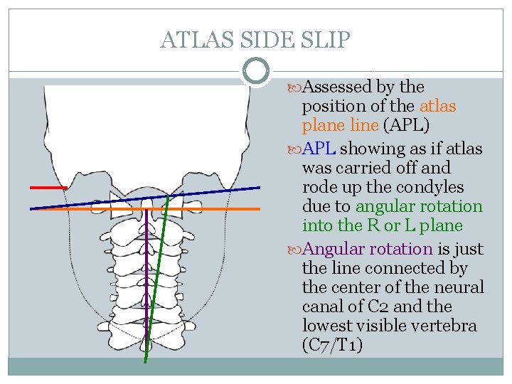 ATLAS SIDE SLIP Assessed by the position of the atlas plane line (APL) APL