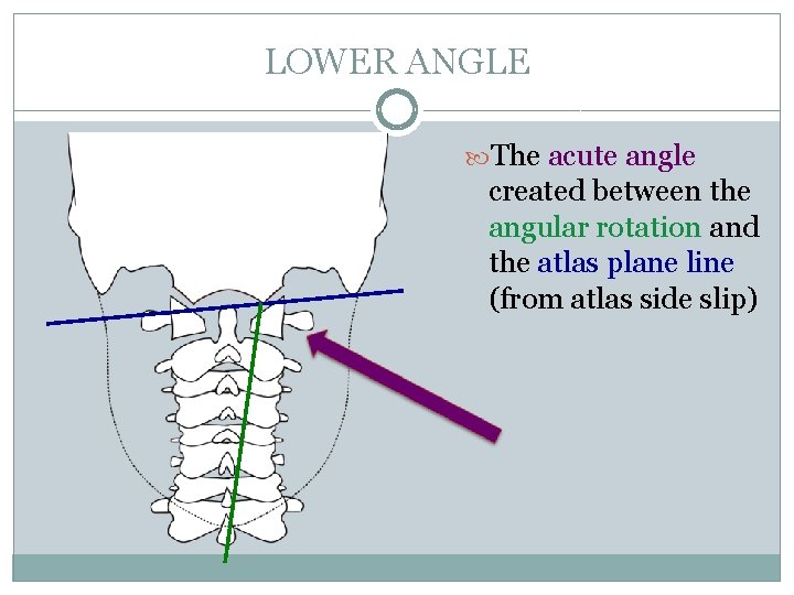 LOWER ANGLE The acute angle created between the angular rotation and the atlas plane