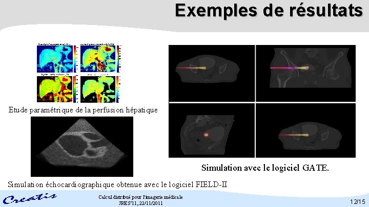 Exemples de résultats Etude paramétrique de la perfusion hépatique Simulation avec le logiciel GATE.