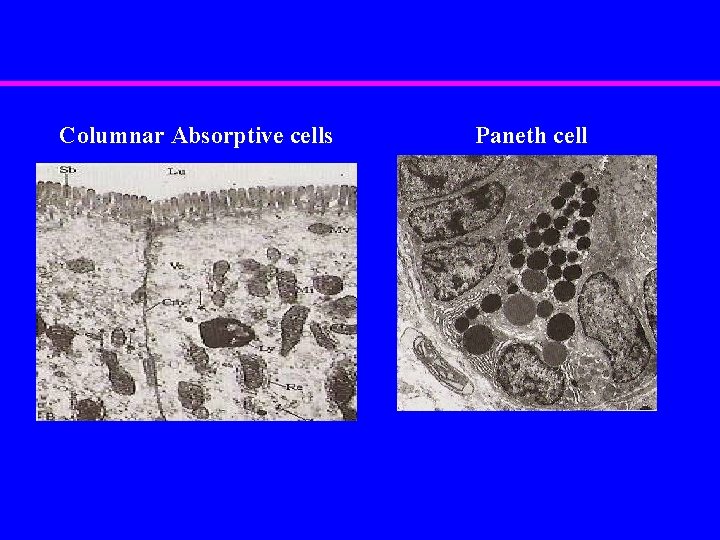 Columnar Absorptive cells Paneth cell 