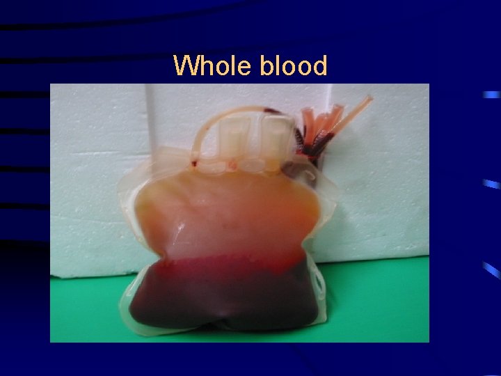 Whole blood 