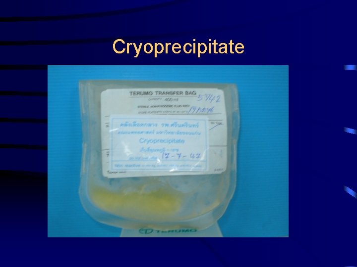 Cryoprecipitate 