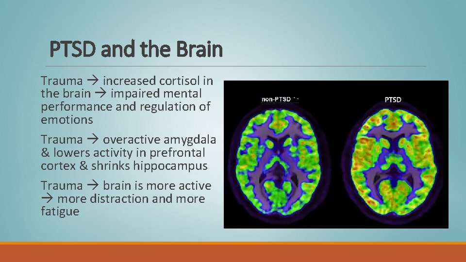 PTSD and the Brain Trauma increased cortisol in the brain impaired mental performance and