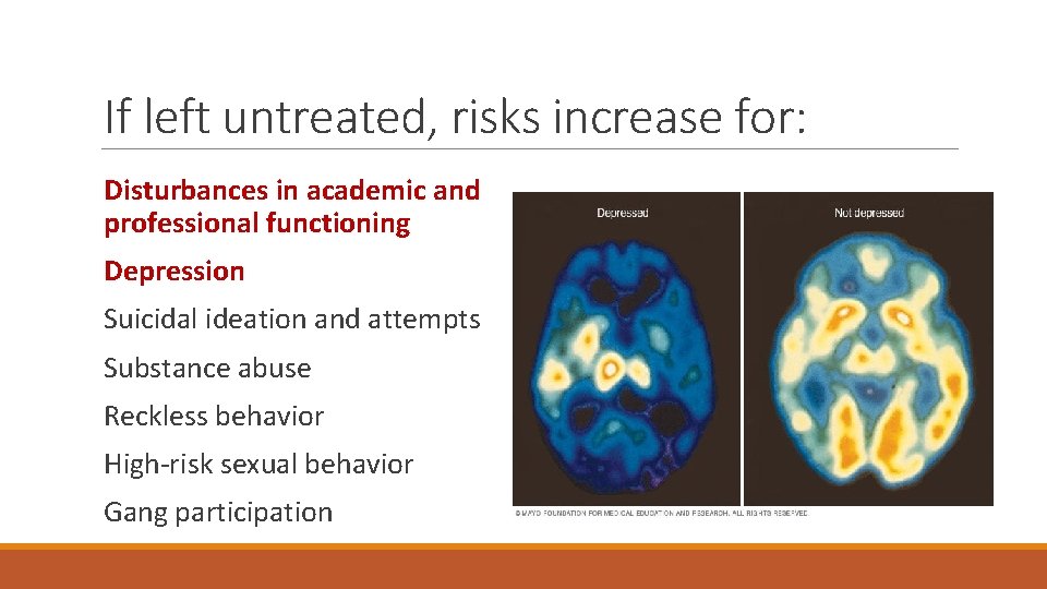 If left untreated, risks increase for: Disturbances in academic and professional functioning Depression Suicidal