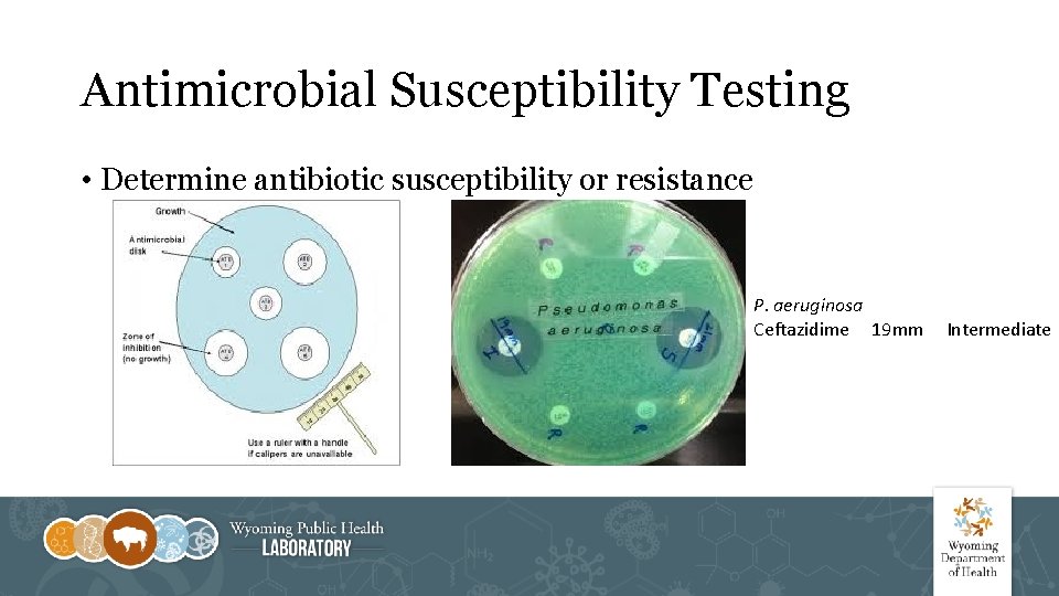 Antimicrobial Susceptibility Testing • Determine antibiotic susceptibility or resistance P. aeruginosa Ceftazidime 19 mm