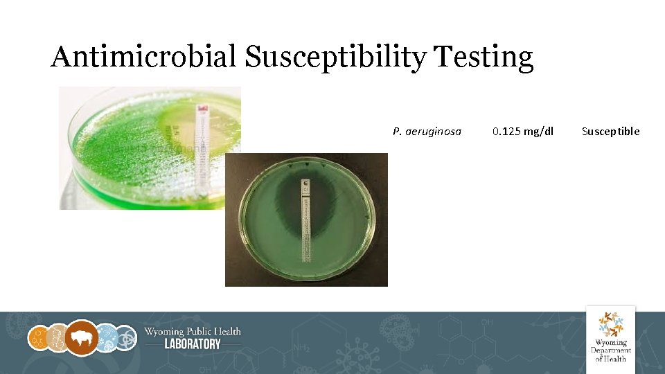 Antimicrobial Susceptibility Testing P. aeruginosa 0. 125 mg/dl Susceptible 