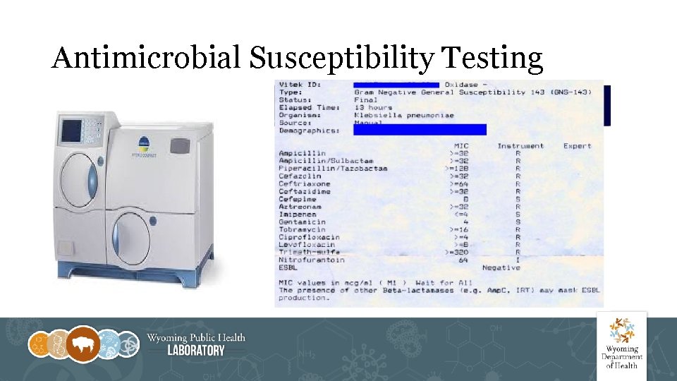Antimicrobial Susceptibility Testing 