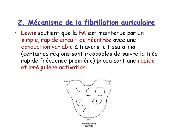 2. Mécanisme de la fibrillation auriculaire • Lewis soutient que la FA est maintenue