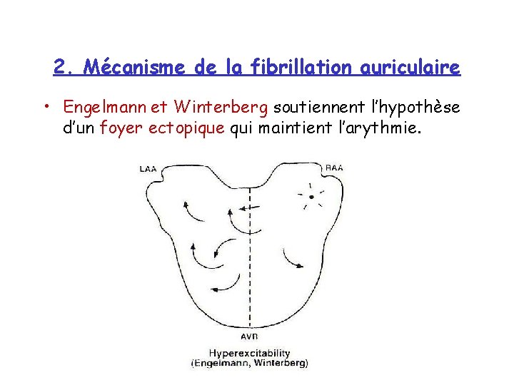 2. Mécanisme de la fibrillation auriculaire • Engelmann et Winterberg soutiennent l’hypothèse d’un foyer