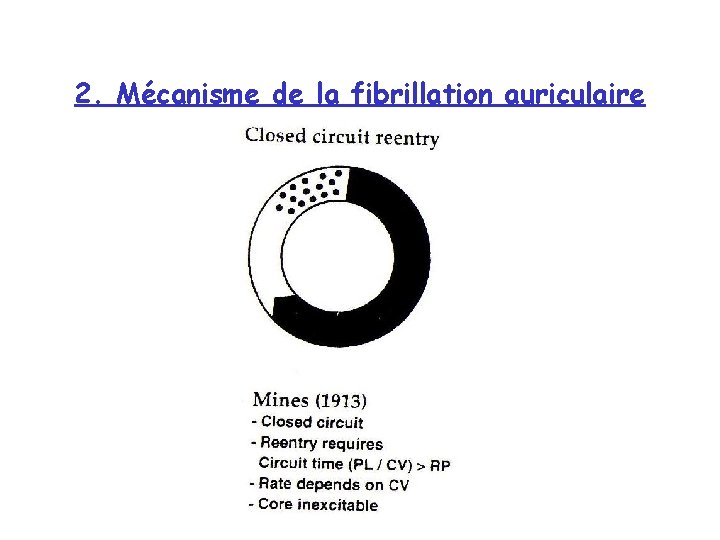 2. Mécanisme de la fibrillation auriculaire 