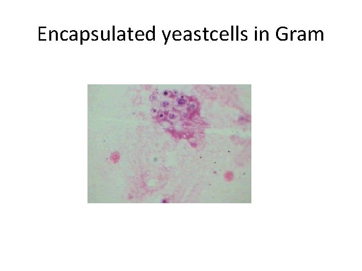 Encapsulated yeastcells in Gram 