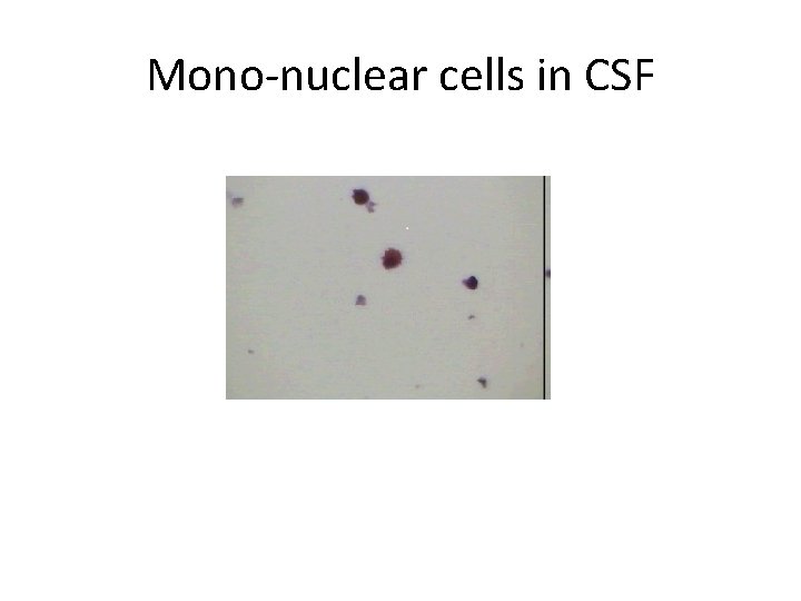 Mono-nuclear cells in CSF 