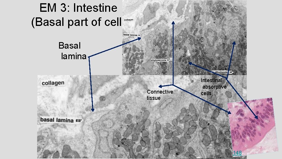 EM 3: Intestine (Basal part of cell) Basal lamina Connective tissue Intestinal absorptive cells