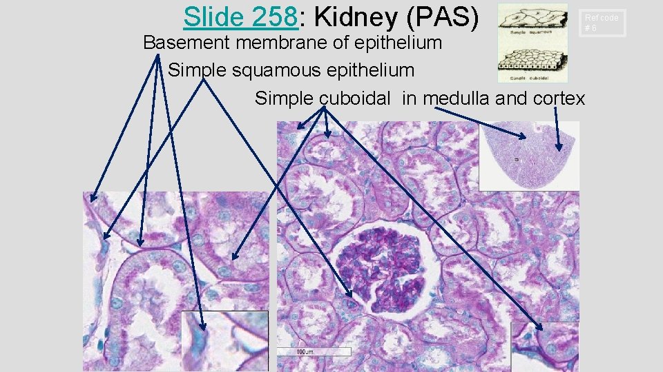 Slide 258: Kidney (PAS) Ref code # 6 Basement membrane of epithelium Simple squamous