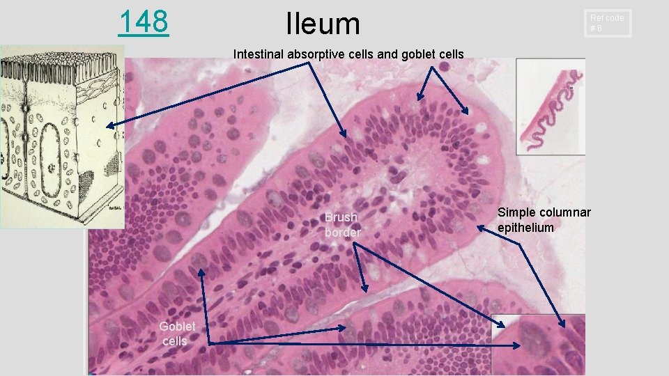 148 Ileum Ref code # 6 Intestinal absorptive cells and goblet cells Brush border