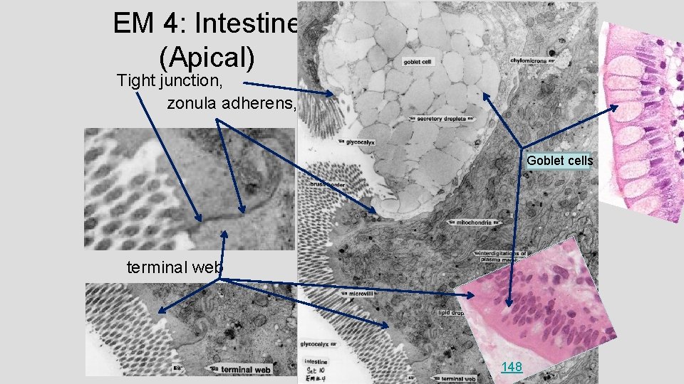 EM 4: Intestine (Apical) Tight junction, zonula adherens, Goblet cells terminal web 148 