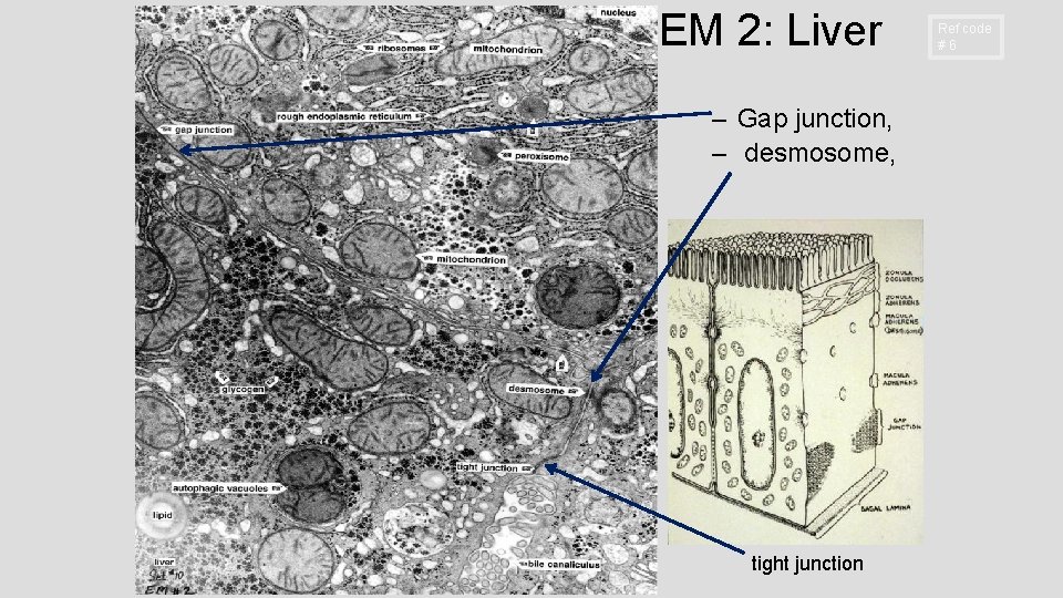 EM 2: Liver – Gap junction, – desmosome, tight junction Ref code # 6