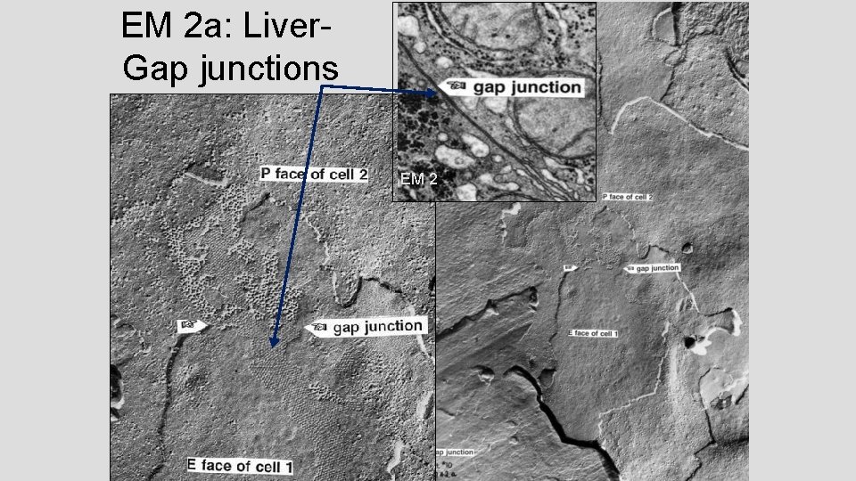 EM 2 a: Liver Gap junctions EM 2 