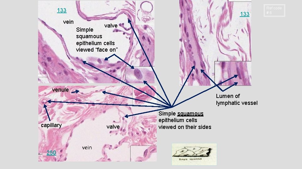 133 vein 133 valve Simple squamous epithelium cells viewed “face on” venule Lumen of