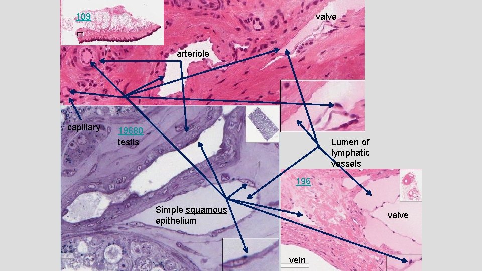 109 valve arteriole capillary 19680 testis Lumen of lymphatic vessels 196 Simple squamous epithelium