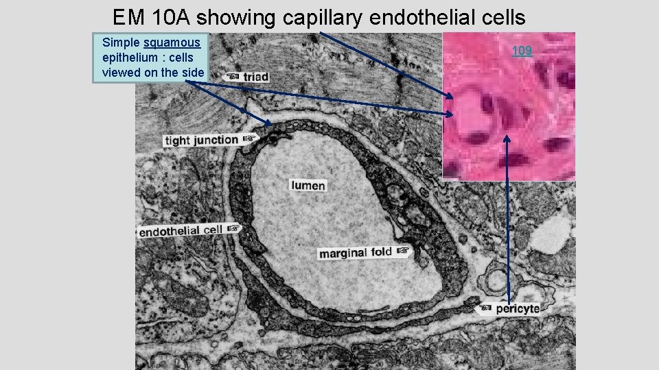 EM 10 A showing capillary endothelial cells Simple squamous epithelium : cells viewed on