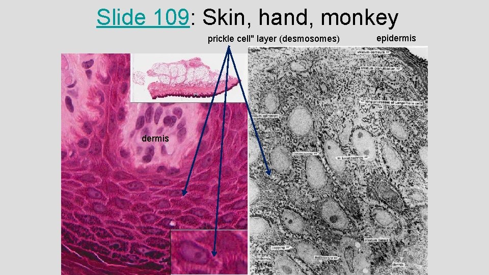 Slide 109: Skin, hand, monkey prickle cell" layer (desmosomes) dermis epidermis 