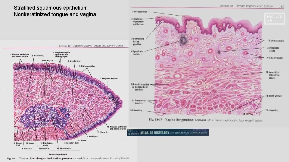 Stratified squamous epithelium Nonkeratinized tongue and vagina Ref code # 5 