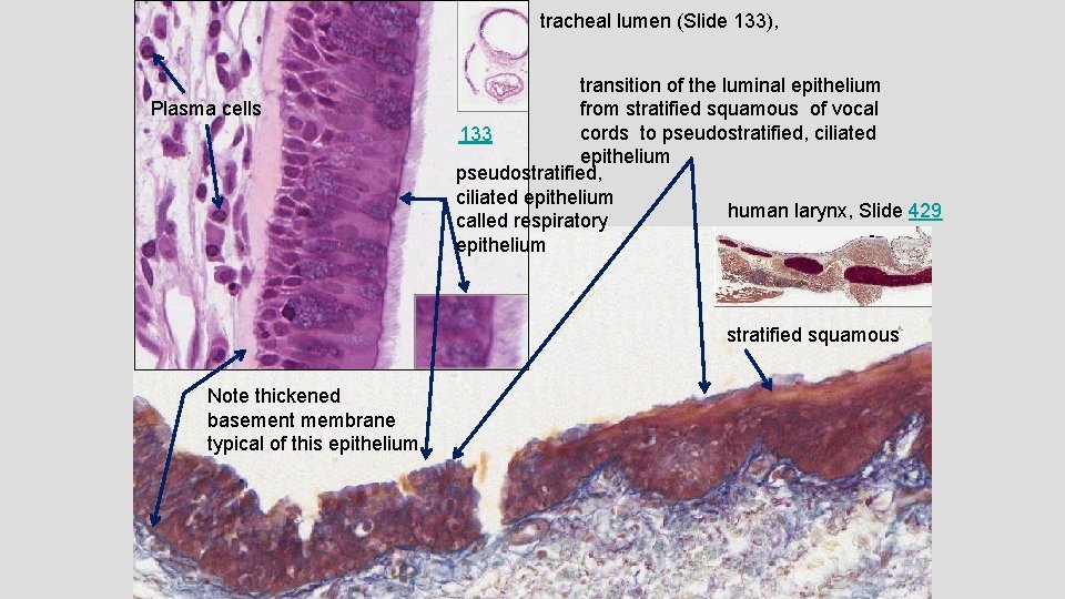 tracheal lumen (Slide 133), Plasma cells transition of the luminal epithelium from stratified squamous
