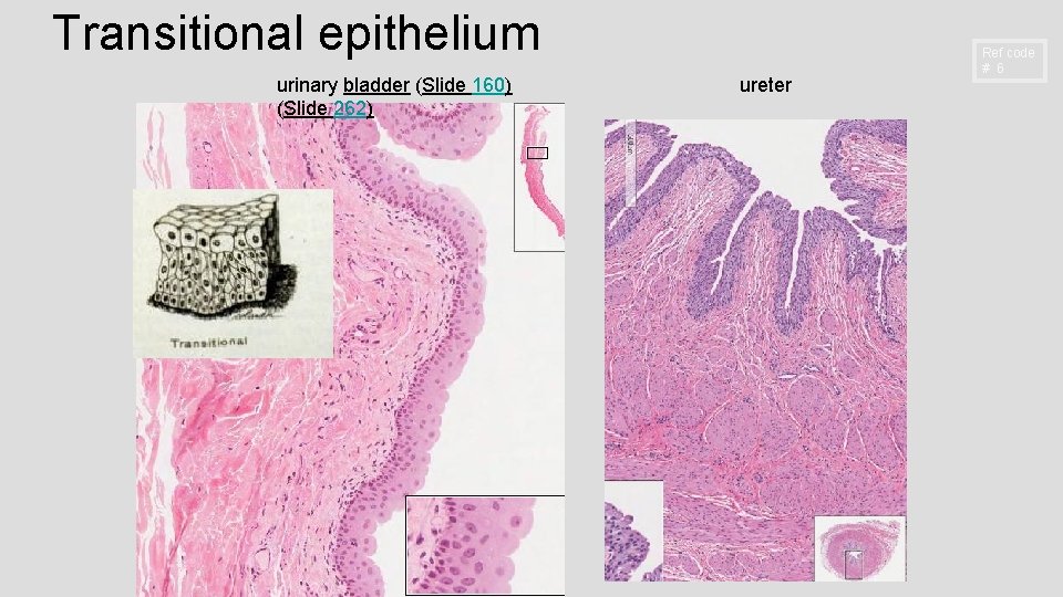 Transitional epithelium urinary bladder (Slide 160) (Slide 262) ureter Ref code # 6 