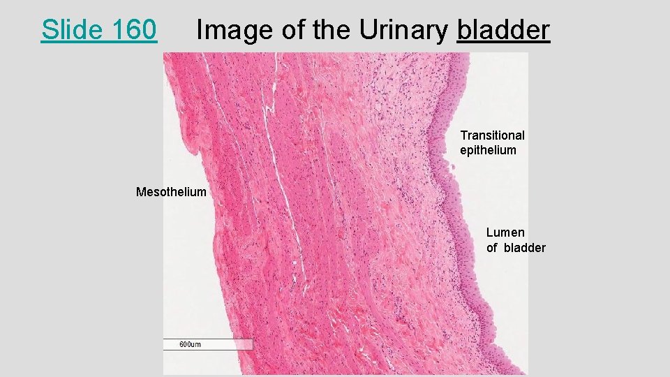 Slide 160 Image of the Urinary bladder Transitional epithelium Mesothelium Lumen of bladder 