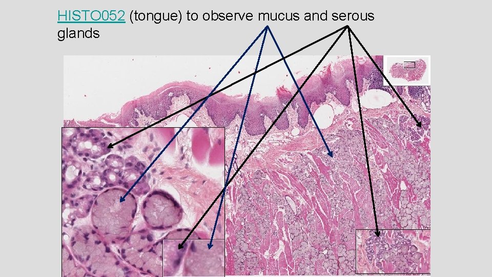 HISTO 052 (tongue) to observe mucus and serous glands 