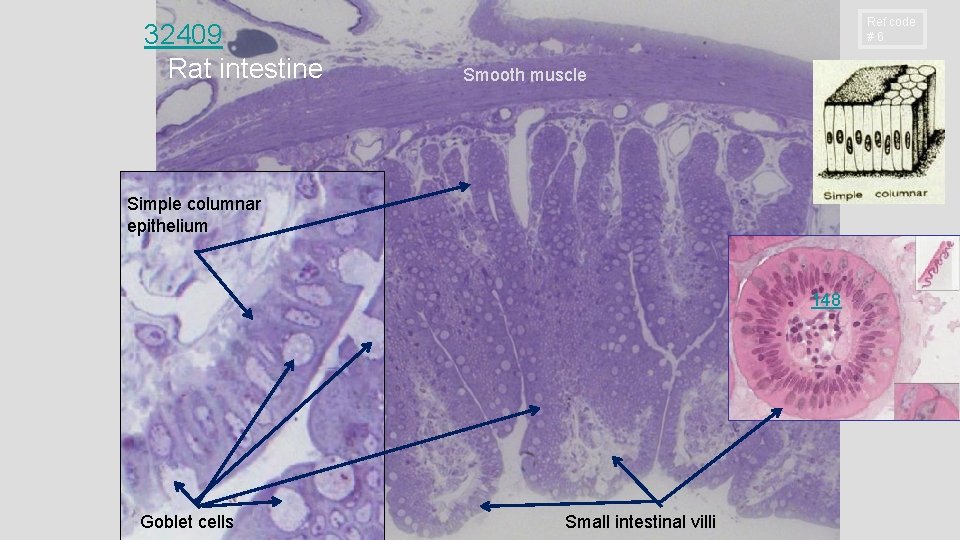 32409 Rat intestine Ref code # 6 Smooth muscle Simple columnar epithelium 148 Goblet