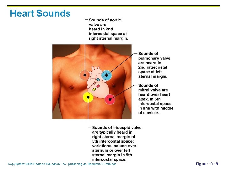 Heart Sounds Copyright © 2006 Pearson Education, Inc. , publishing as Benjamin Cummings Figure