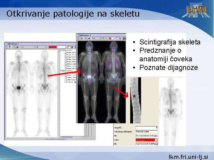 Otkrivanje patologije na skeletu • Scintigrafija skeleta • Predznanje o anatomiji čoveka • Poznate