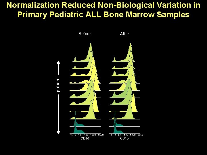 patient Normalization Reduced Non-Biological Variation in Primary Pediatric ALL Bone Marrow Samples 
